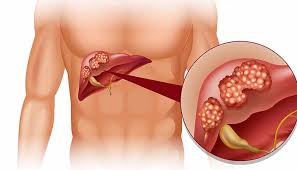 LIVER FUNCTION TEST 